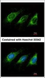 AID Polyclonal Antibody
