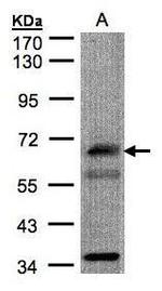 CHFR Polyclonal Antibody