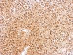 RNF25 Antibody in Immunohistochemistry (Paraffin) (IHC (P))