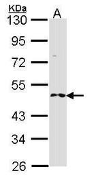 RNF25 Antibody in Western Blot (WB)