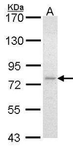 FZD8 Antibody in Western Blot (WB)