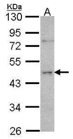 ORC4 Antibody in Western Blot (WB)