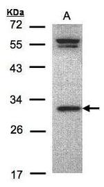 ORC6 Antibody in Western Blot (WB)