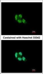 PSMB5 Polyclonal Antibody