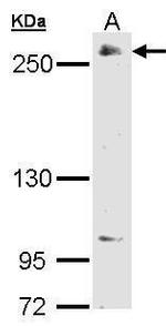 POLR2A Antibody in Western Blot (WB)