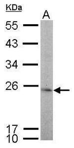 TBPL1 Antibody in Western Blot (WB)