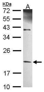TBPL1 Antibody in Western Blot (WB)