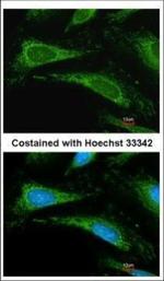 Cyclophilin A Antibody in Immunocytochemistry (ICC/IF)