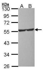 HTR1A Antibody in Western Blot (WB)