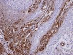 RASGRP3 Antibody in Immunohistochemistry (Paraffin) (IHC (P))