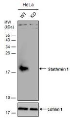 Stathmin 1 Antibody in Western Blot (WB)