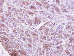 HPK1 Antibody in Immunohistochemistry (Paraffin) (IHC (P))