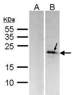 DUSP14 Polyclonal Antibody