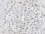 CacyBP Antibody in Immunohistochemistry (Paraffin) (IHC (P))