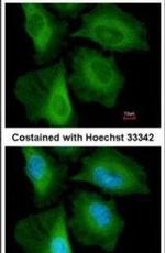 CacyBP Antibody in Immunocytochemistry (ICC/IF)