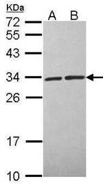 CacyBP Antibody in Western Blot (WB)
