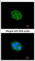 SPHK1 Polyclonal Antibody