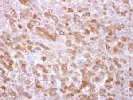 TRPM7 Antibody in Immunohistochemistry (Paraffin) (IHC (P))