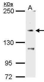 TRPM7 Antibody in Western Blot (WB)