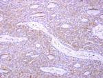 p41-ARCb Polyclonal Antibody