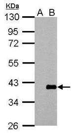 ARPC1A Antibody in Western Blot (WB)