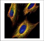 VDAC2 Polyclonal Antibody