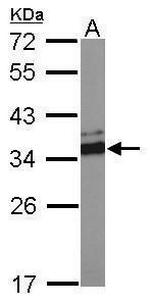 VDAC2 Antibody in Western Blot (WB)