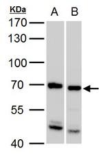 SSX2IP Polyclonal Antibody