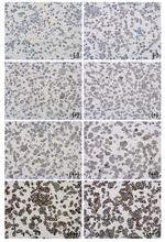 PD-L1 Antibody in Immunohistochemistry (Paraffin) (IHC (P))