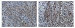 PD-L1 Antibody in Immunohistochemistry (Paraffin) (IHC (P))