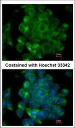 SIPA1 Polyclonal Antibody