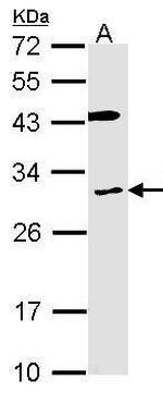 CYBRD1 Polyclonal Antibody