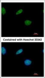 LXR beta Polyclonal Antibody