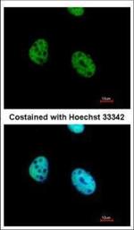 ATF7 Polyclonal Antibody