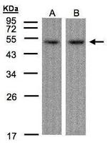 ATF7 Antibody in Western Blot (WB)