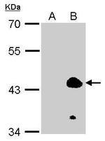EKLF Polyclonal Antibody