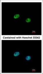 IRF5 Polyclonal Antibody