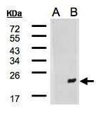 DNAJB9 Polyclonal Antibody