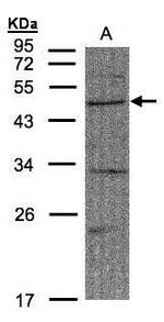 FBXW2 Polyclonal Antibody