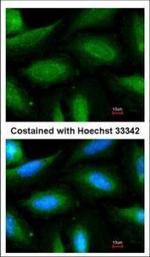 FBXL2 Polyclonal Antibody