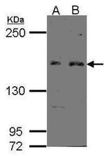 FBXL10 Antibody in Western Blot (WB)