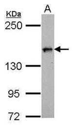 FBXL10 Antibody in Western Blot (WB)