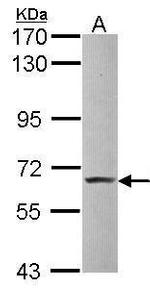 Pokemon Antibody in Western Blot (WB)
