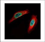 CLIC4 Polyclonal Antibody