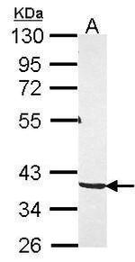 PKA gamma Polyclonal Antibody