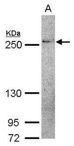 THADA Polyclonal Antibody