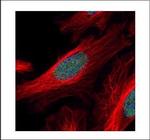 ZNF38 Polyclonal Antibody