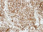 HLA-DRB1 Polyclonal Antibody