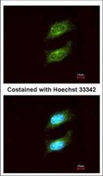 PKA alpha Antibody in Immunocytochemistry (ICC/IF)