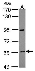 CYP4F12 Polyclonal Antibody